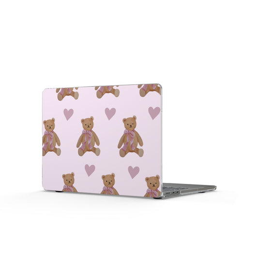 Honey Haze MacBook Case