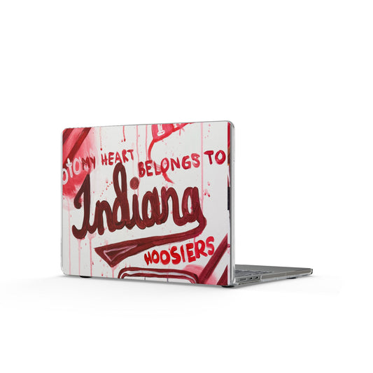 IU MacBook Case