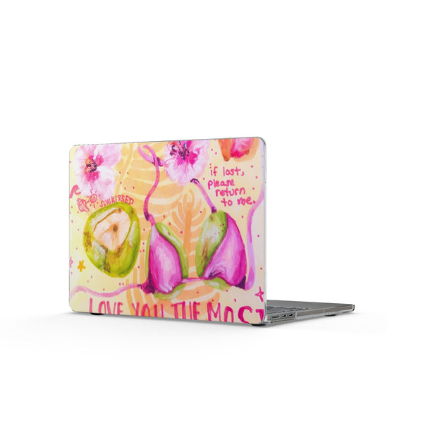 Summer Souvenir MacBook Case